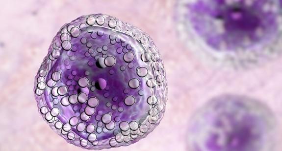 Wirus HTLV 1 – jakie choroby powoduje wirus T-limfotropowy?