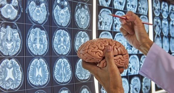 Operacja mózgu – przebieg najpowszechniejszych zabiegów i czas ich trwania