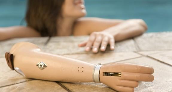 Proteza ręki standardowa i bioniczna – zastosowanie i koszty