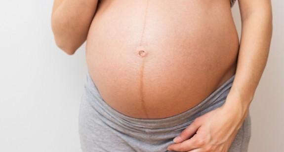 Linea negra – znak ciąży czy schorzenie. Czy jest powodem do niepokoju?