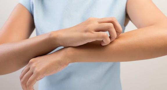 Wysypka na ramionach u dzieci i dorosłych – możliwe przyczyny i sposoby leczenia