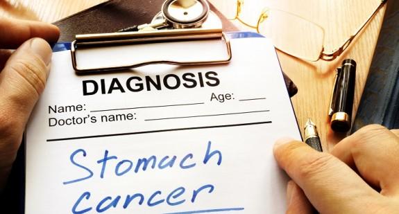 Rak żołądka – rokowania i ocena stopnia zaawansowania choroby
