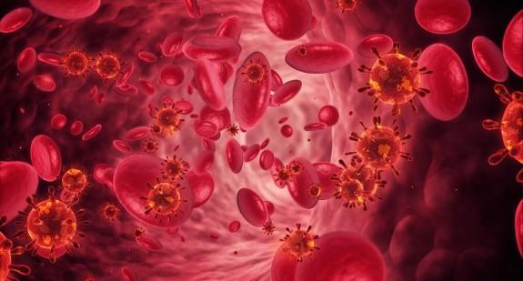 Naczyniak krwionośny – rodzaje, umiejscowienie, leczenie