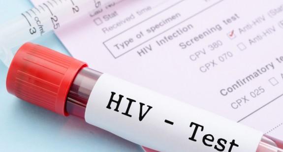 Sposoby zarażenia się HIV. Czy stosunek oralny powoduje zarażenie HIV?