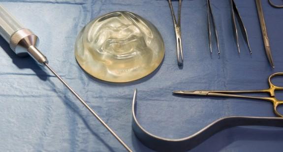 Co ile lat trzeba wymieniać implanty? 