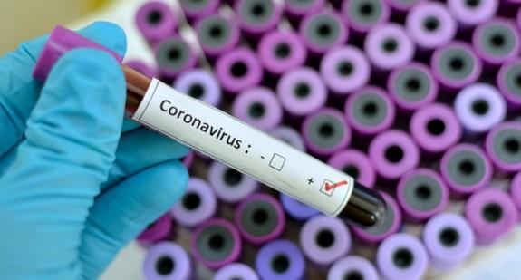 Najmłodsza ofiara koronawirusa w Europie. Dziewczynka zmarła w wieku 12 lat