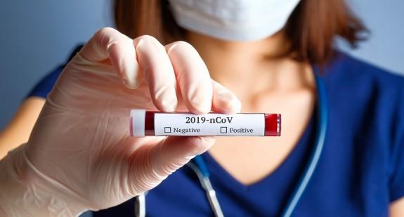 Kiedy skończy się pandemia koronawirusa SARs-CoV-2 ?