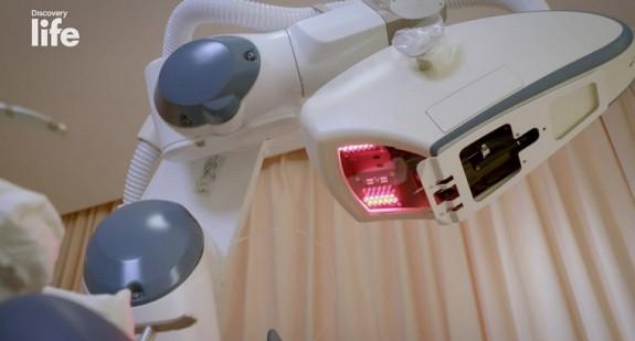 Czy robot może wykonać przeszczep włosów? 