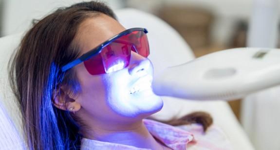 Laserowe wybielanie zębów – cena, efekty, przebieg zabiegu
