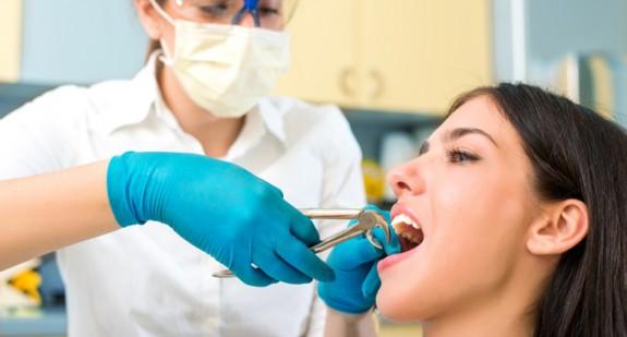 Ile utrzymuje się skrzep po wyrwaniu zęba? Prawidłowy przebieg gojenia i komplikacje