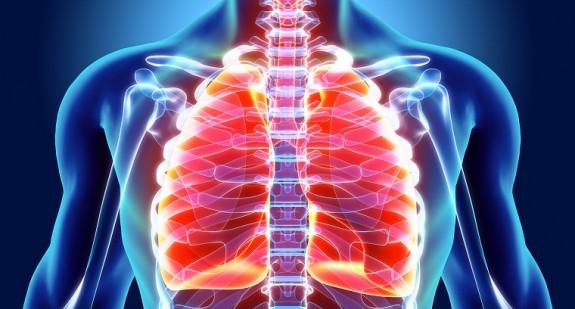 Nacieki na płucach – objawy, przyczyny i możliwe leczenie. Czy naciek na płucach to nowotwór?