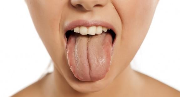 Żółty nalot na języku – przyczyny i leczenie, żółty nalot na języku u dziecka
